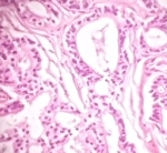 707adenoprost.jpg